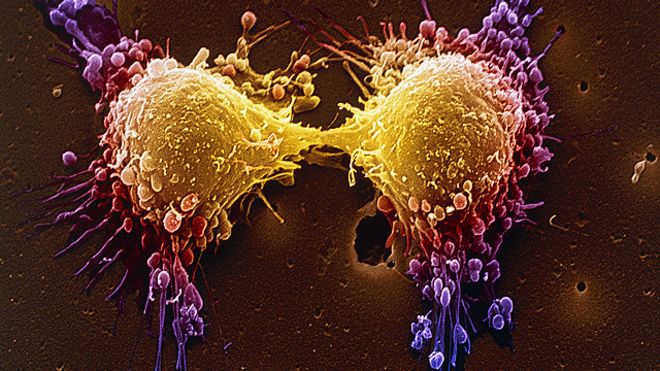 Nova terapia genética faz células de câncer cometerem 'suicídio'