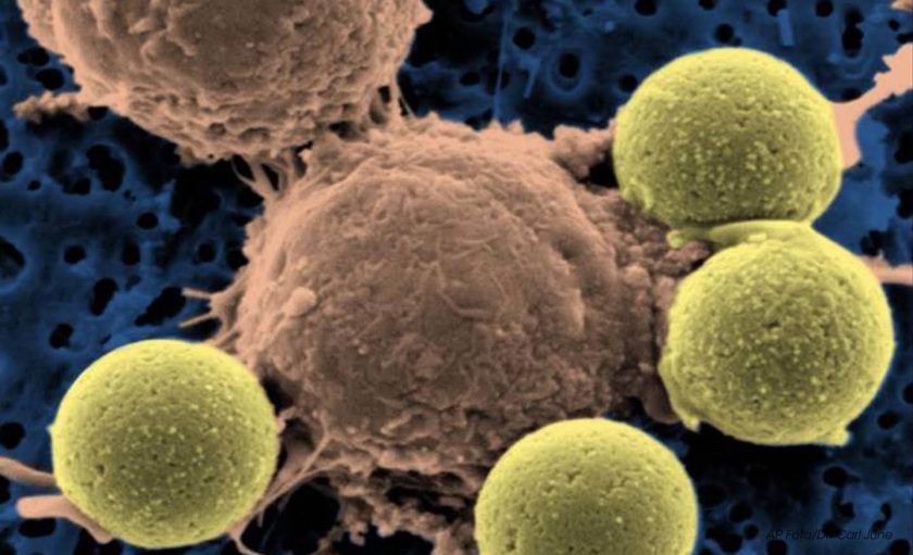 Estudo descobre código que faz células cancerosas voltarem a ser saudáveis