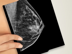 Pesquisa aponta a eficácia da Mamografia 3D