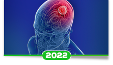 Gliomas