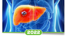 Carcinoma hepatocelular